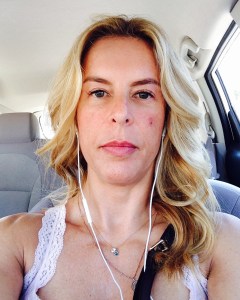 Pic before procedure, note the birthmark red spot